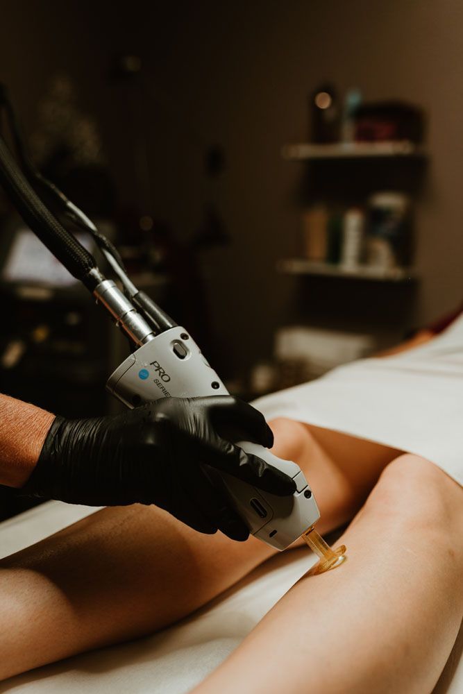 A woman is getting a laser hair removal treatment on her leg.