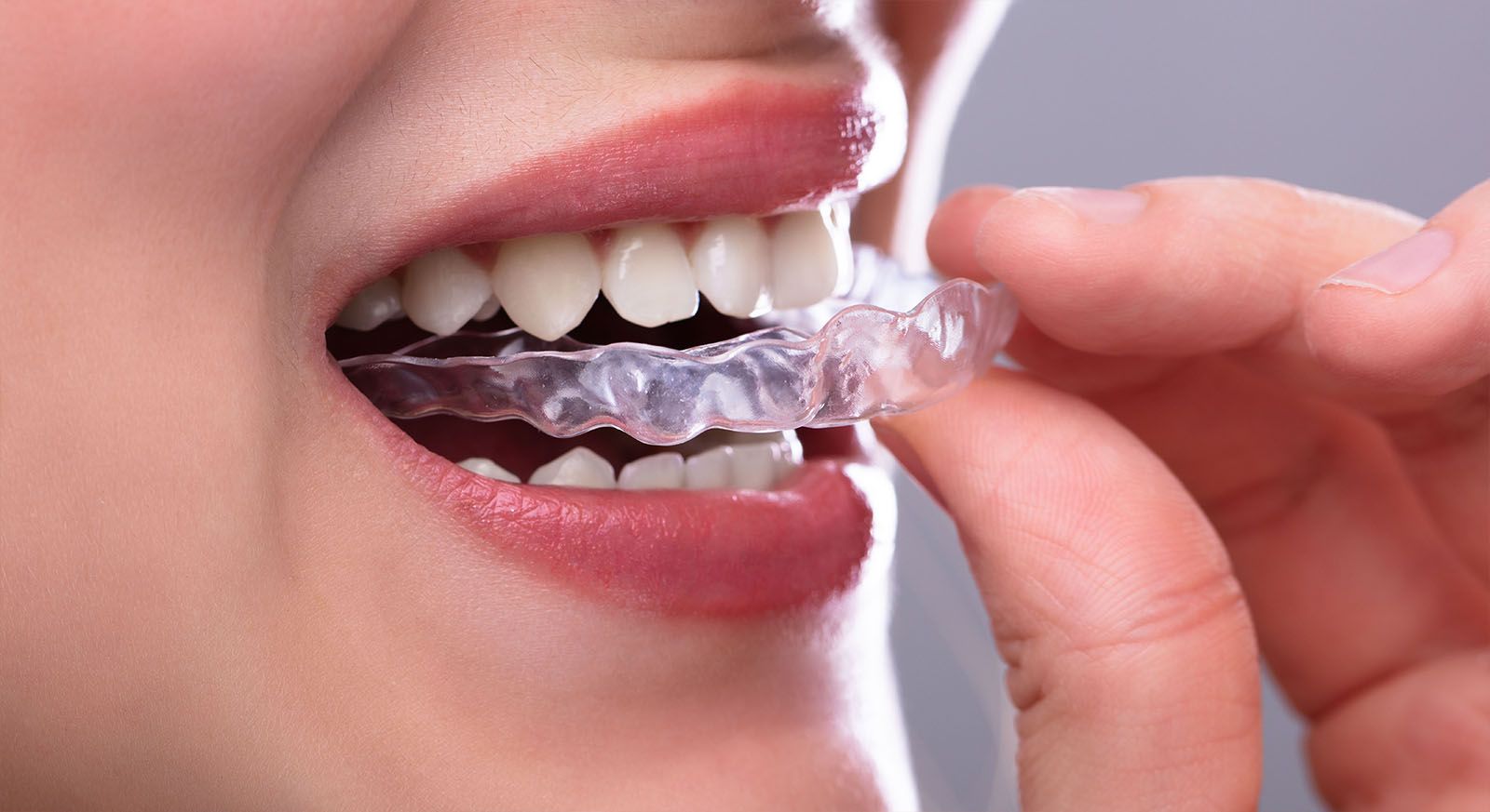 A person with long brown hair and a nose ring smiles, showing metal braces, while sitting in a clinical setting.