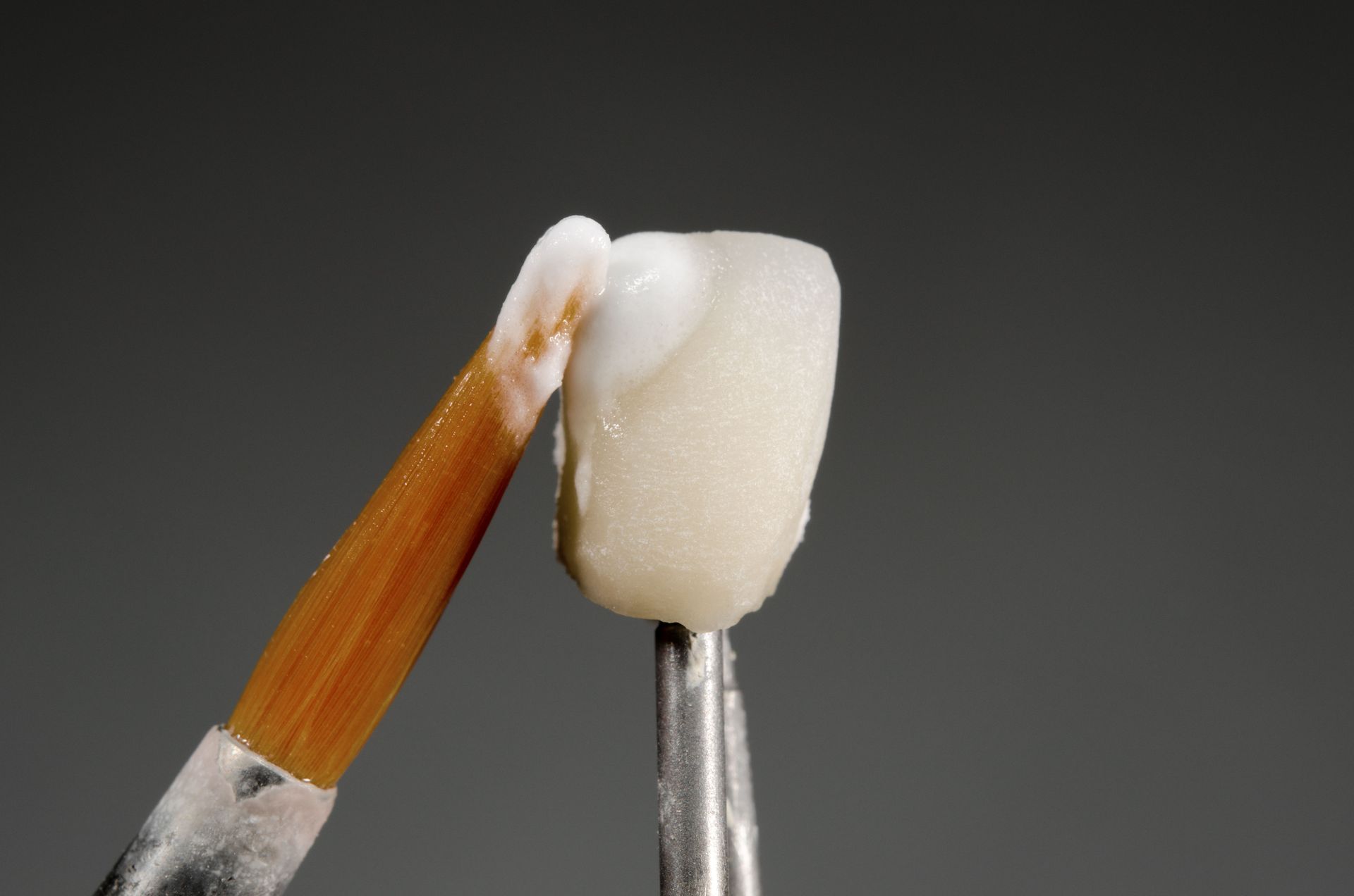 Virginia Beach, VA dentist for veneers
