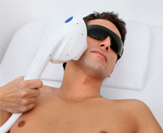 exceptional-laser-hair-removal