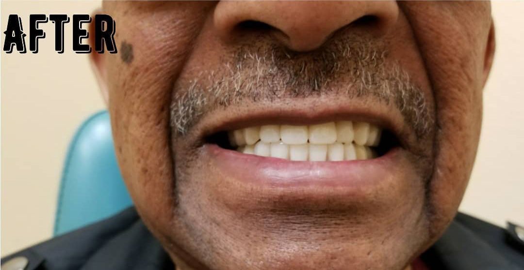 a close up of a man 's teeth