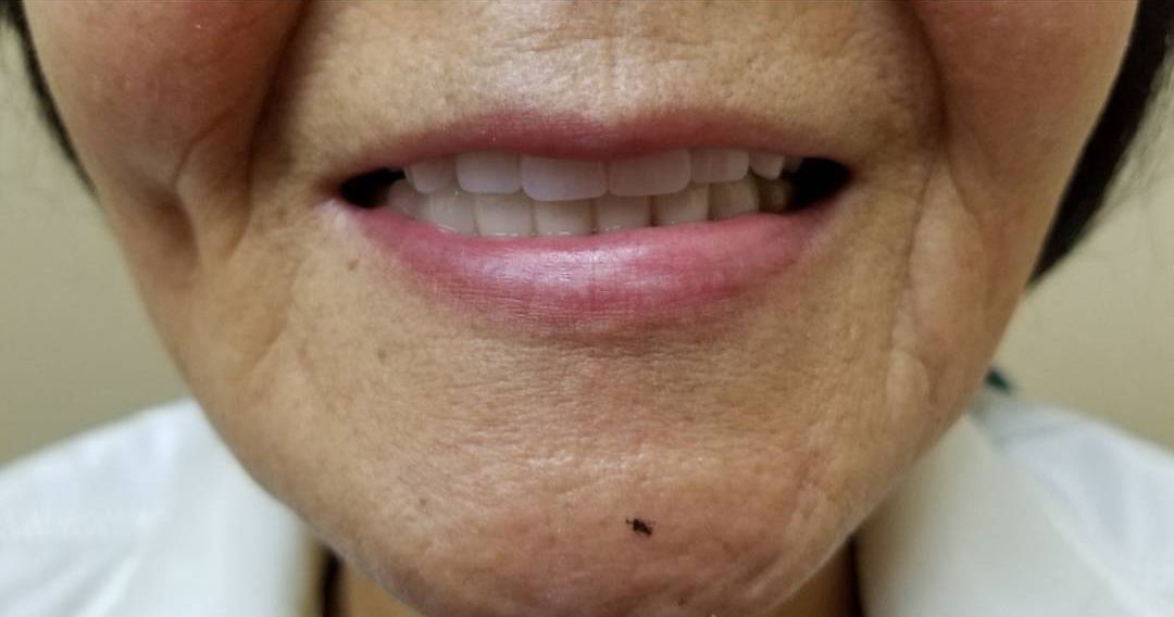 a close up of a woman 's mouth and teeth .