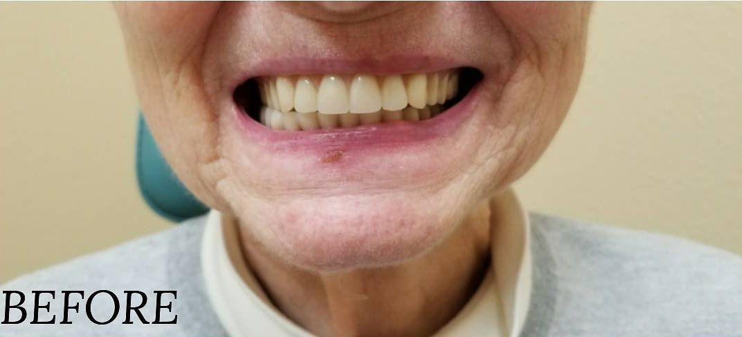 a close up of a woman 's mouth with a smile on her face.