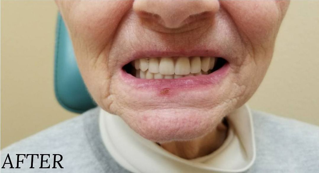 a close up of a woman 's mouth and teeth .