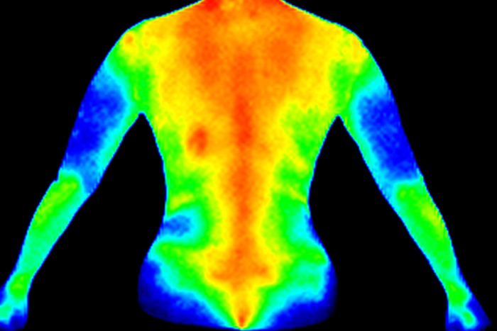 A thermal image of a person 's back and arms.