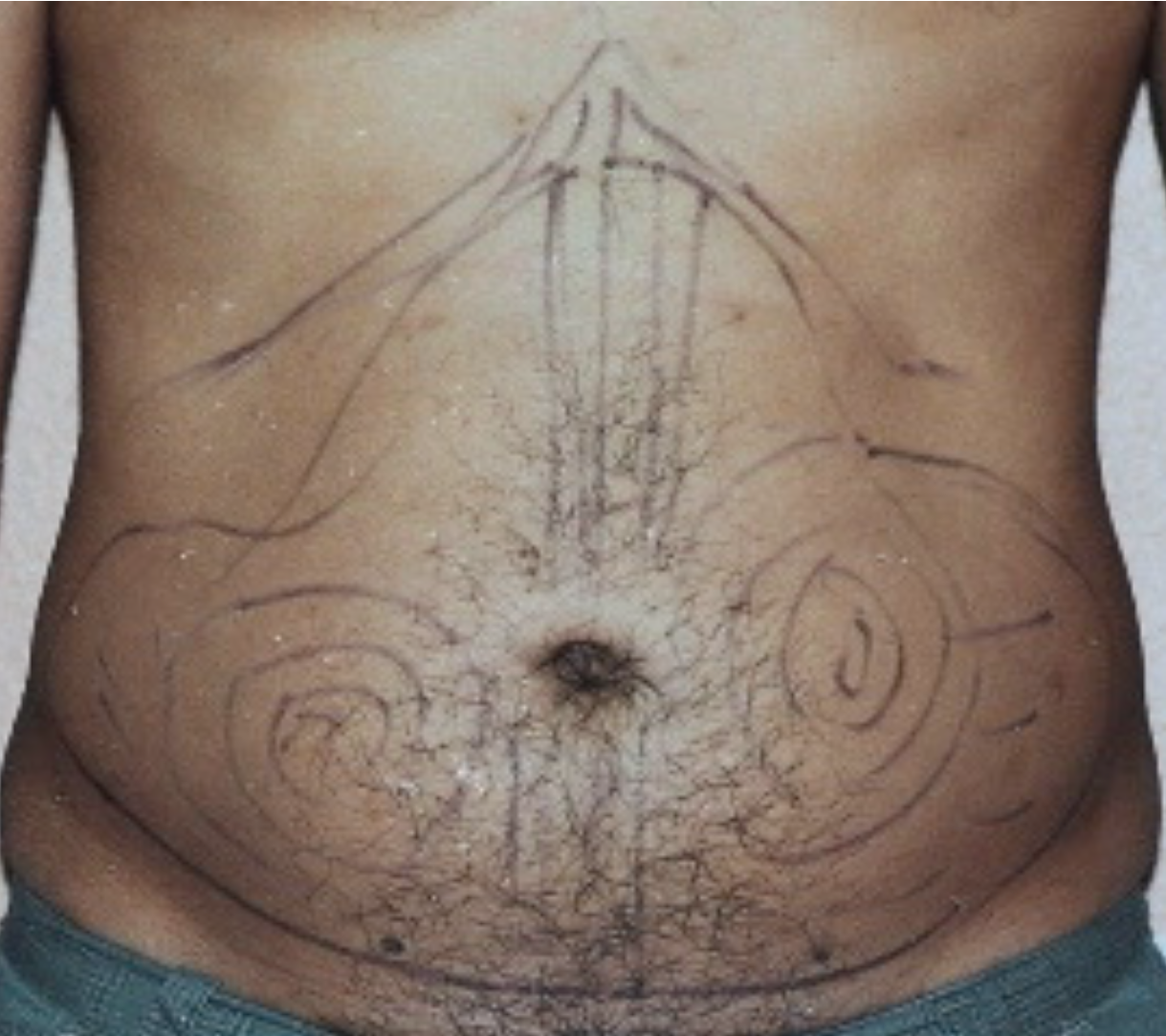A close up of a man 's stomach with a drawing on it