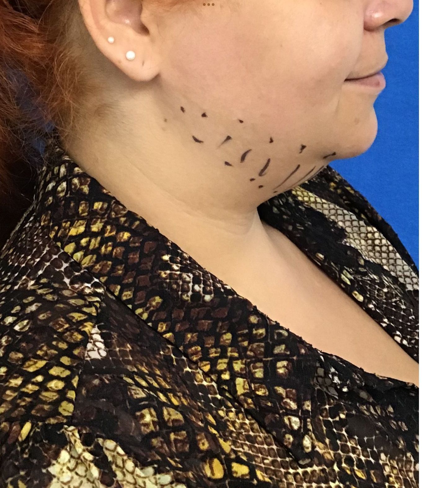 A woman in a snake print shirt has lines drawn on her neck