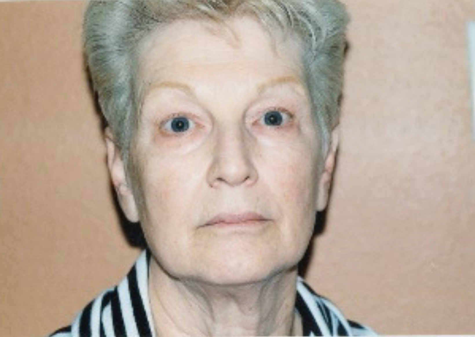 A close up of a woman 's face with a striped shirt on