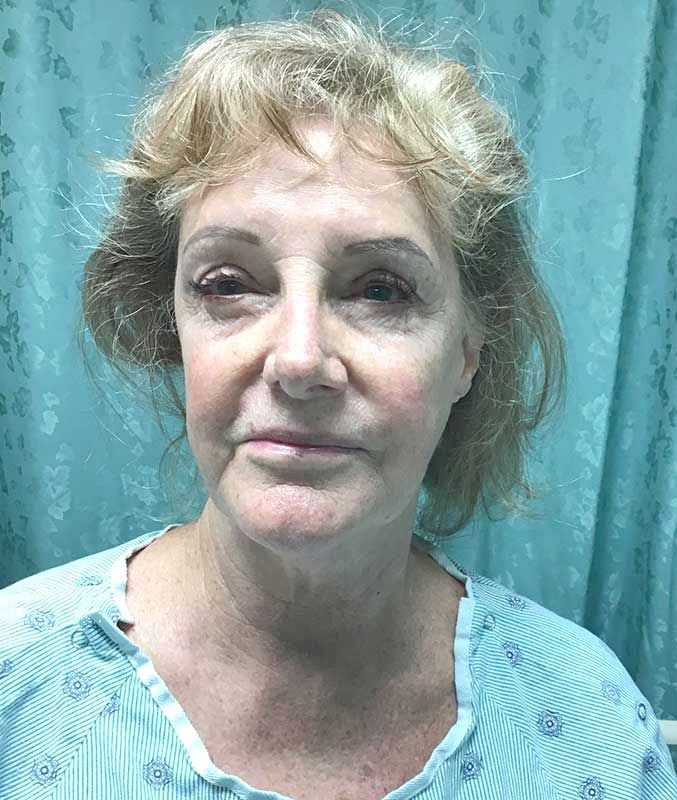 A woman in a hospital gown is sitting in a hospital bed