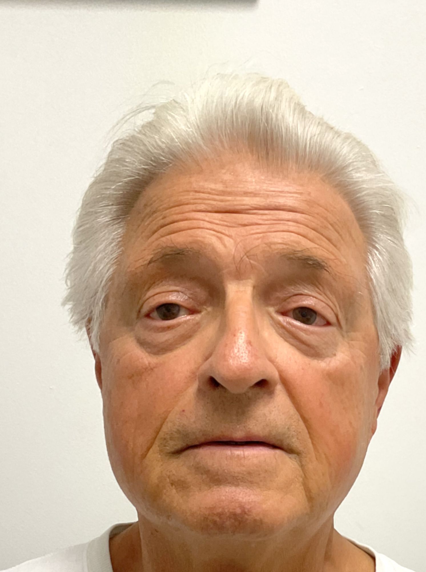 An older man with white hair is looking at the camera