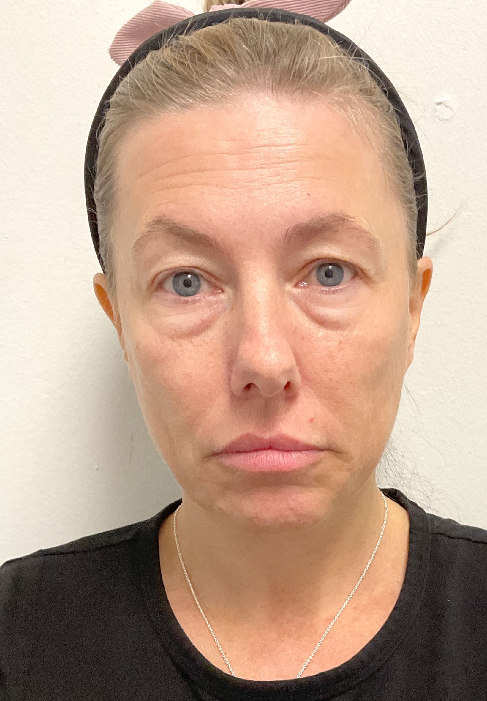 A woman wearing a headband and a black shirt is looking at the camera