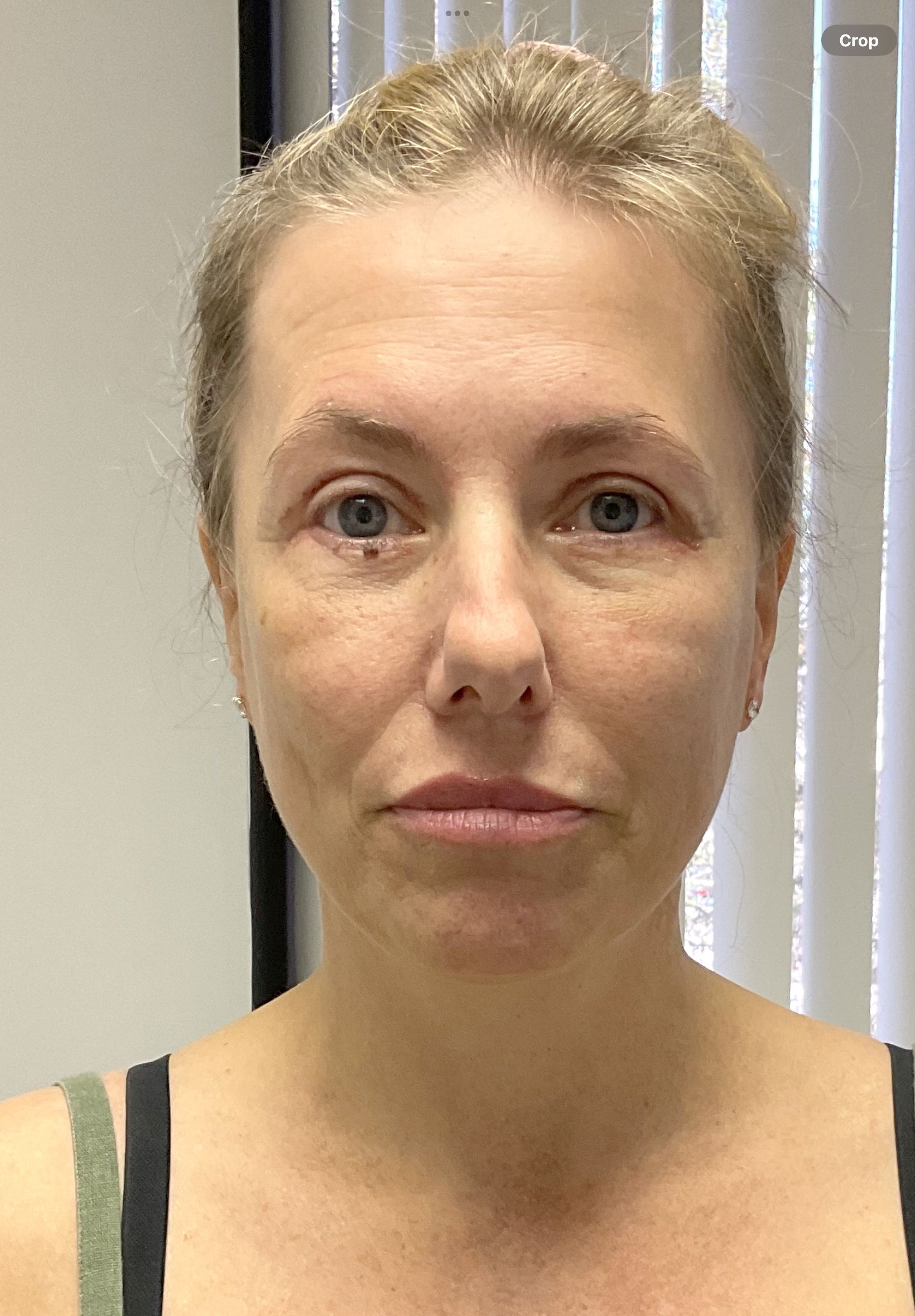 A woman without makeup is looking at the camera