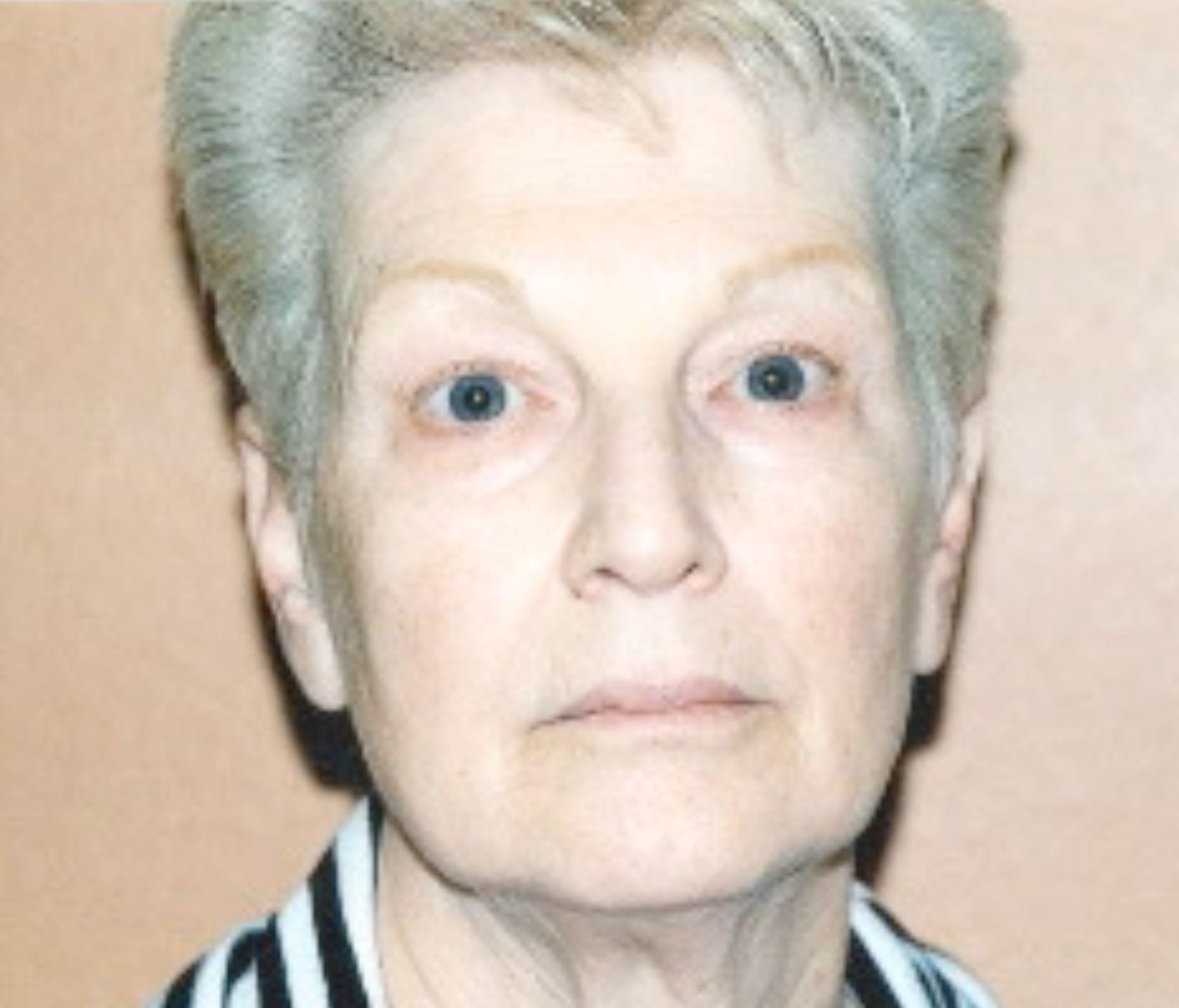 A close up of a woman's face with a striped shirt on