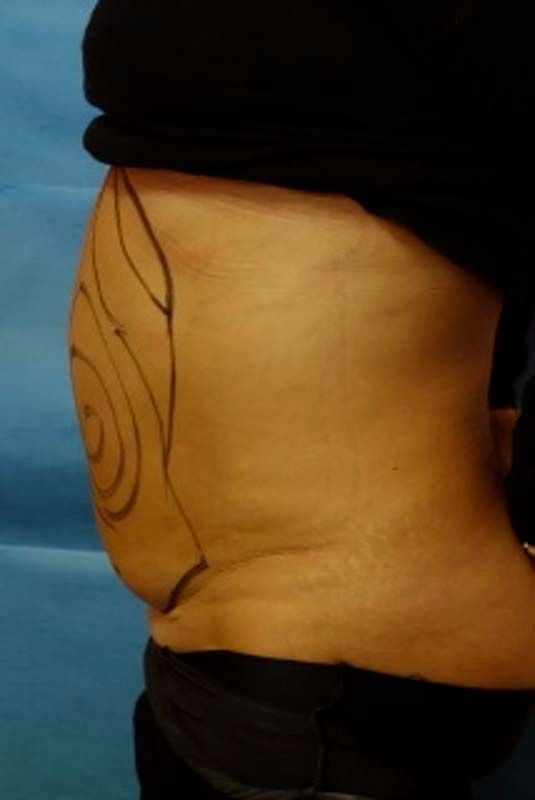 A woman's stomach with a drawing on it.