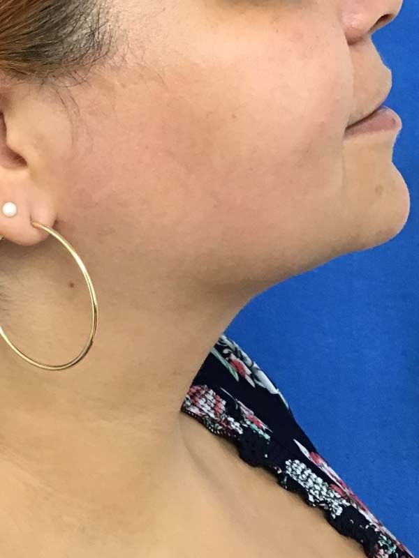 A close up of a woman's neck and ear with hoop earrings.