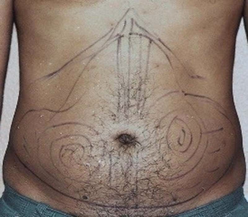 A man's stomach with a drawing on it