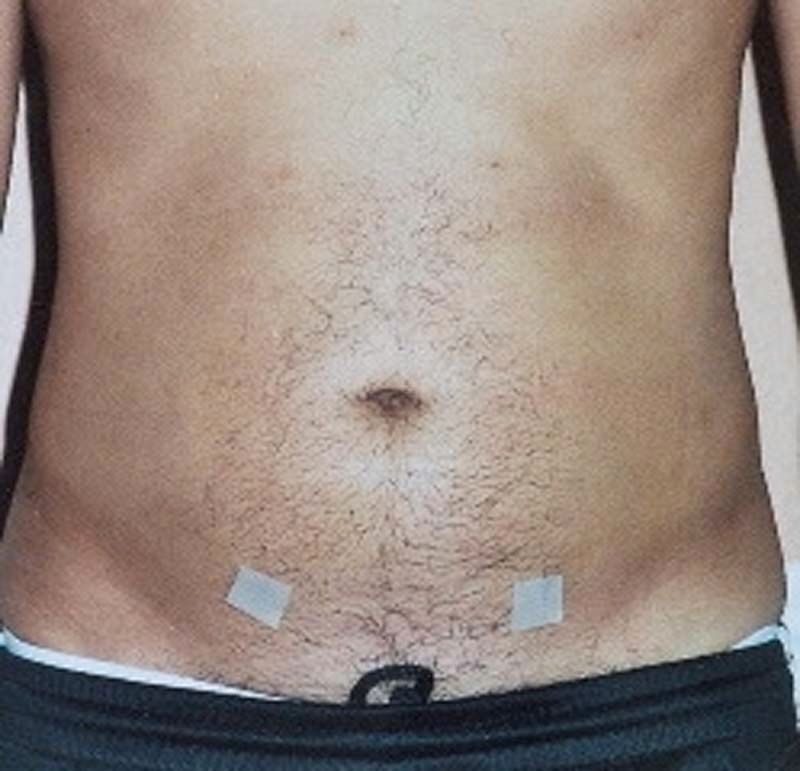A close up of a man's stomach with tape on it.