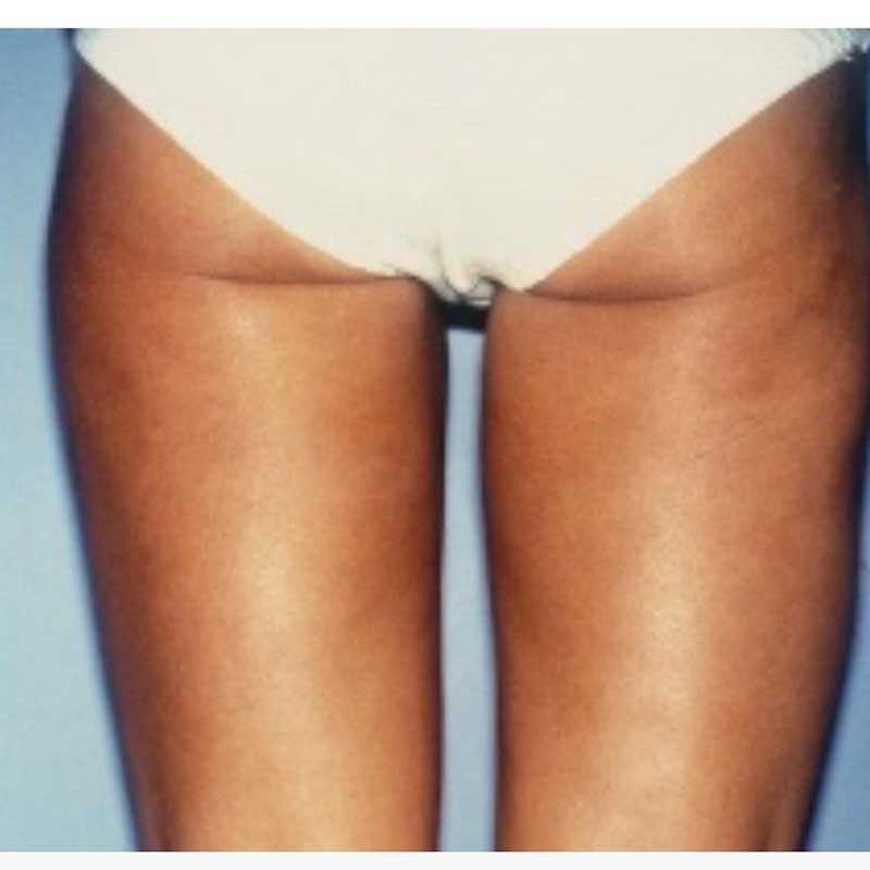 A woman 's legs are shown in a white bikini