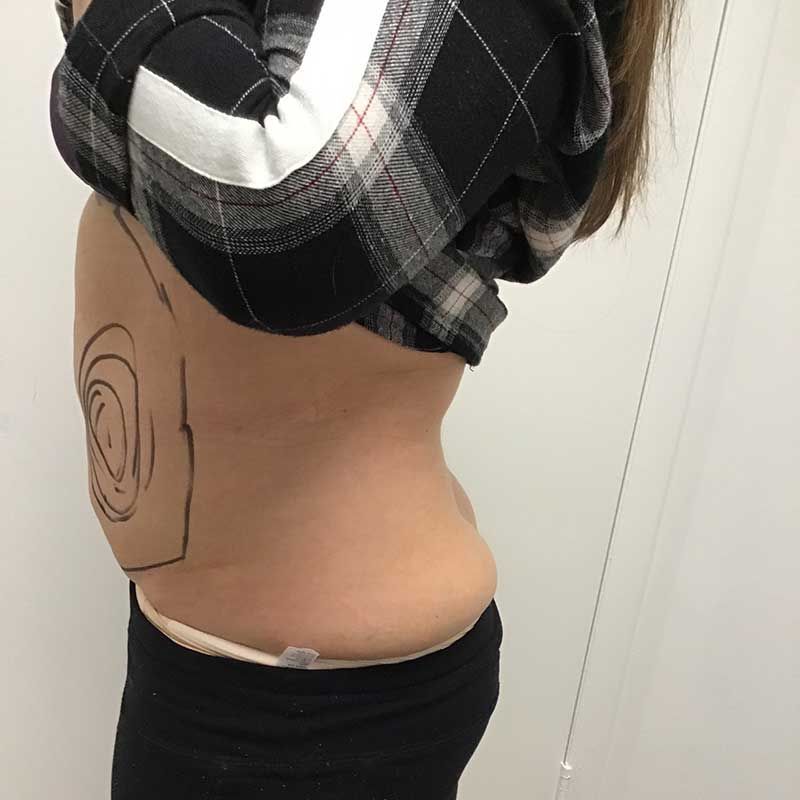 A woman in a plaid shirt has a drawing on her stomach