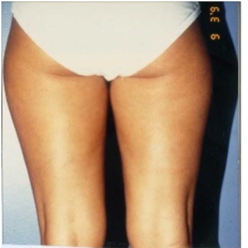 A picture of a woman 's legs with the number 6 on the bottom