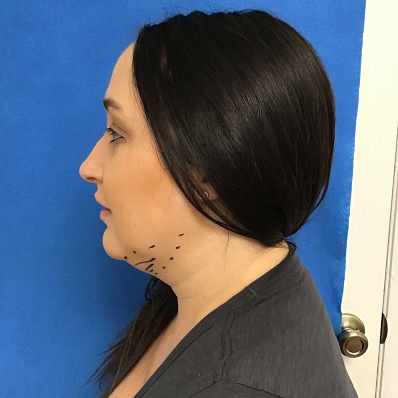 A woman with a tattoo on her neck is standing in front of a blue curtain.