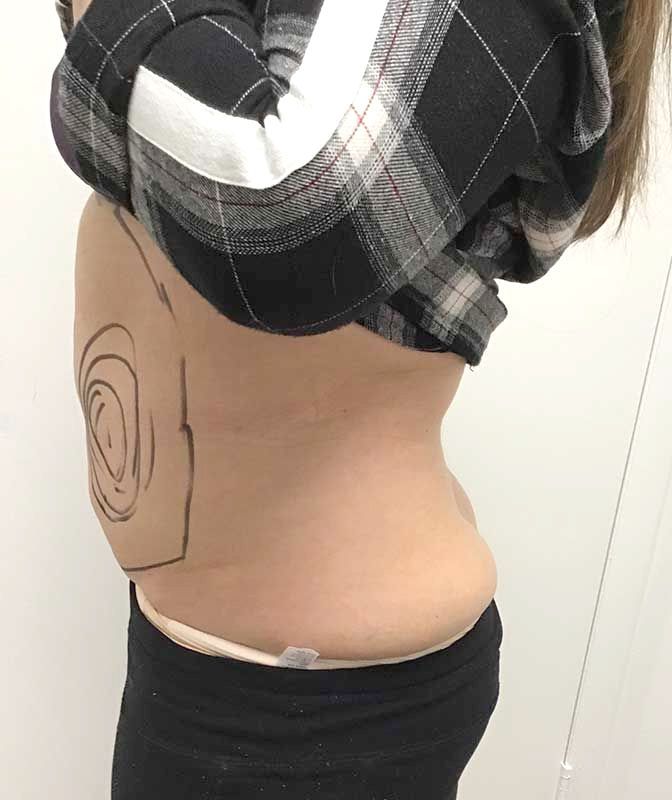 A woman in a plaid shirt has a drawing on her stomach