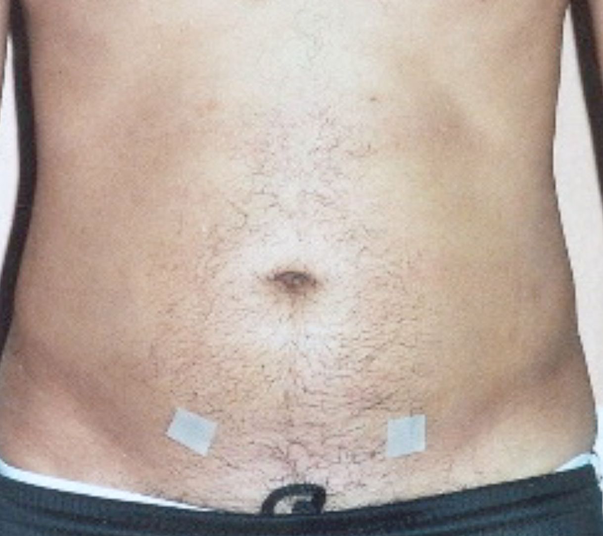 A close up of a man's stomach with tape on it