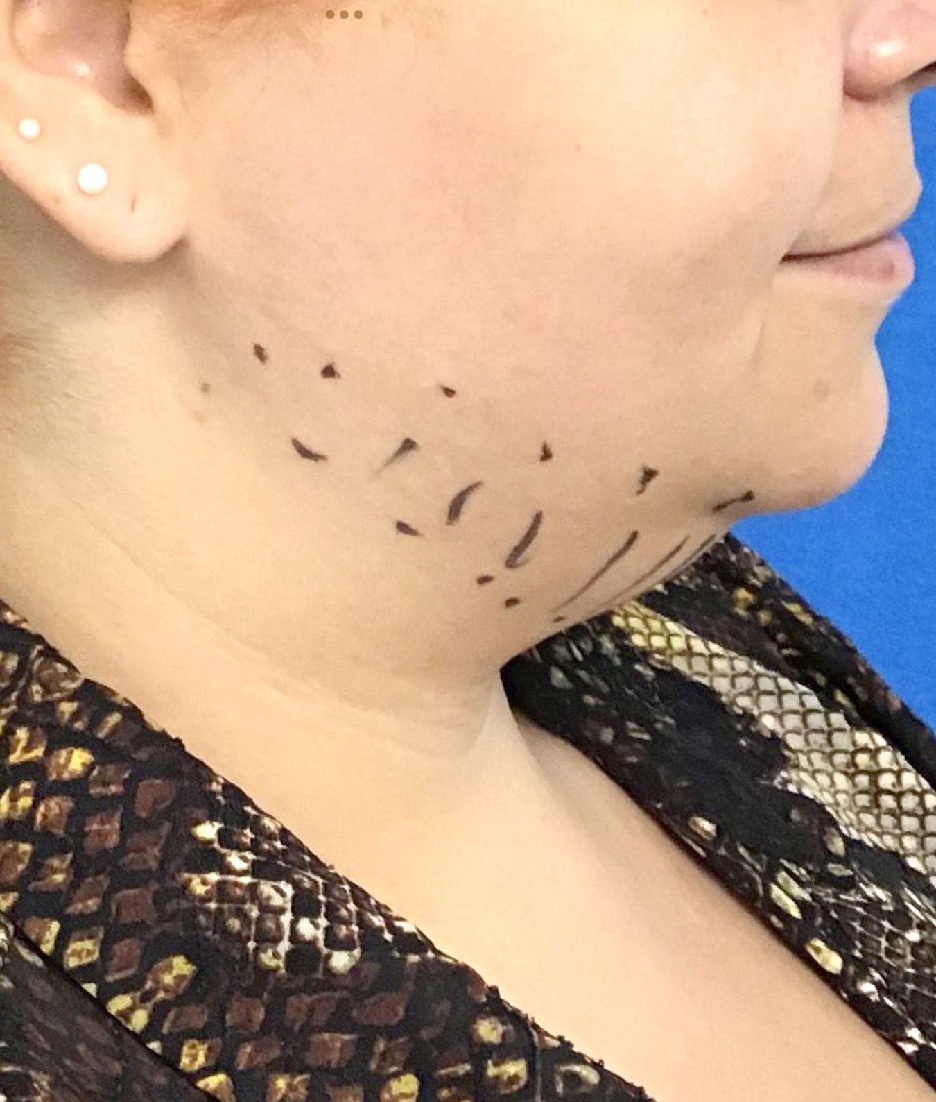 A woman in a snake print shirt has lines drawn on her neck
