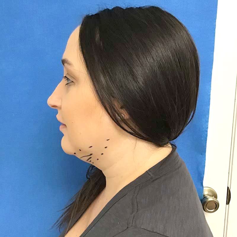 A woman with a tattoo on her neck is standing in front of a blue curtain