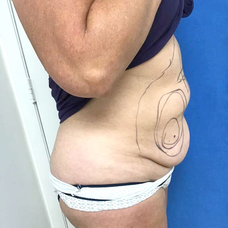 A woman with a drawing of a circle on her stomach