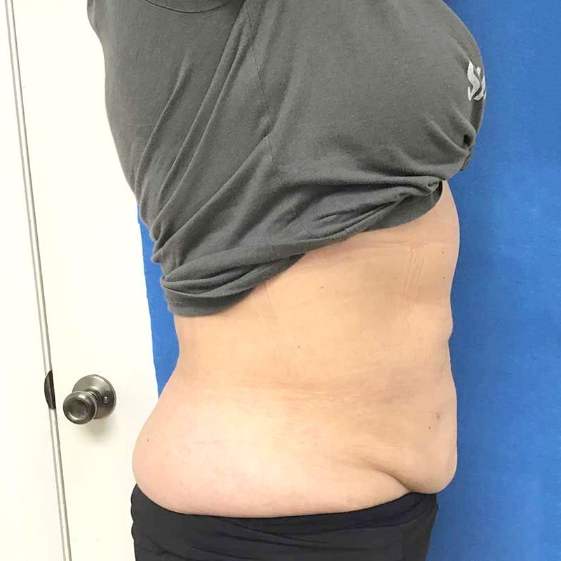 A woman 's stomach is shown in a gray shirt and black shorts.