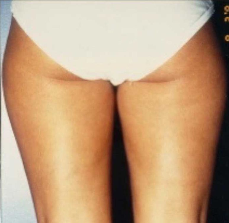 A picture of a woman's legs with the number 6 on the bottom