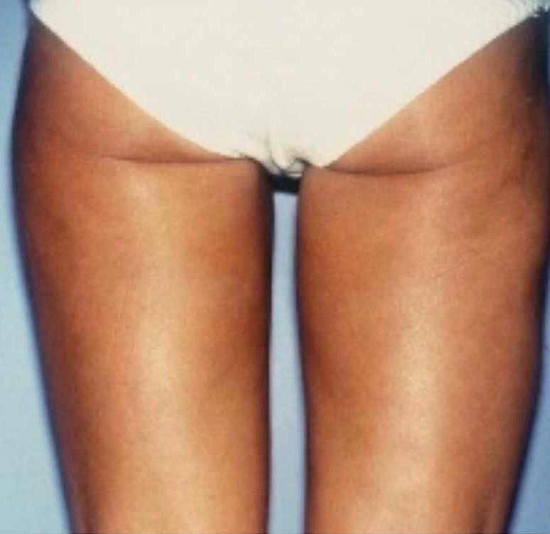 A woman 's legs are shown in a white bikini