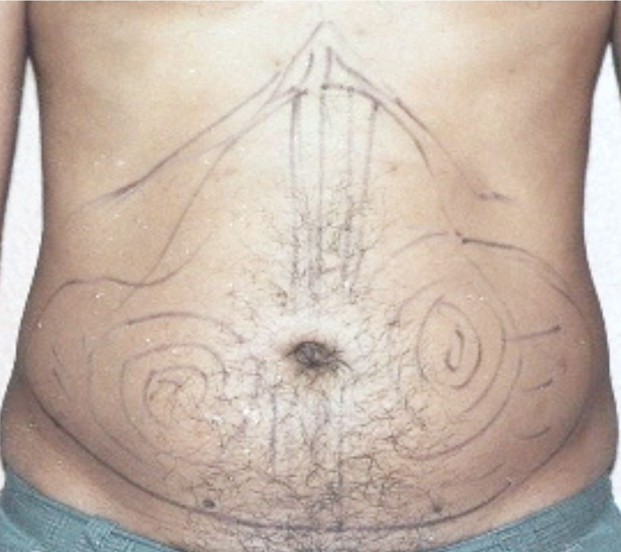 A close up of a man's stomach with a drawing on it