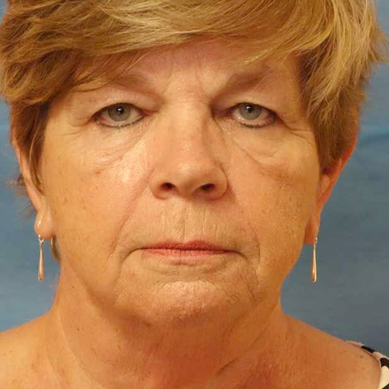 A woman wearing a striped shirt and earrings is looking at the camera
