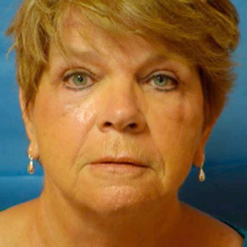 A close up of a woman's face wearing earrings