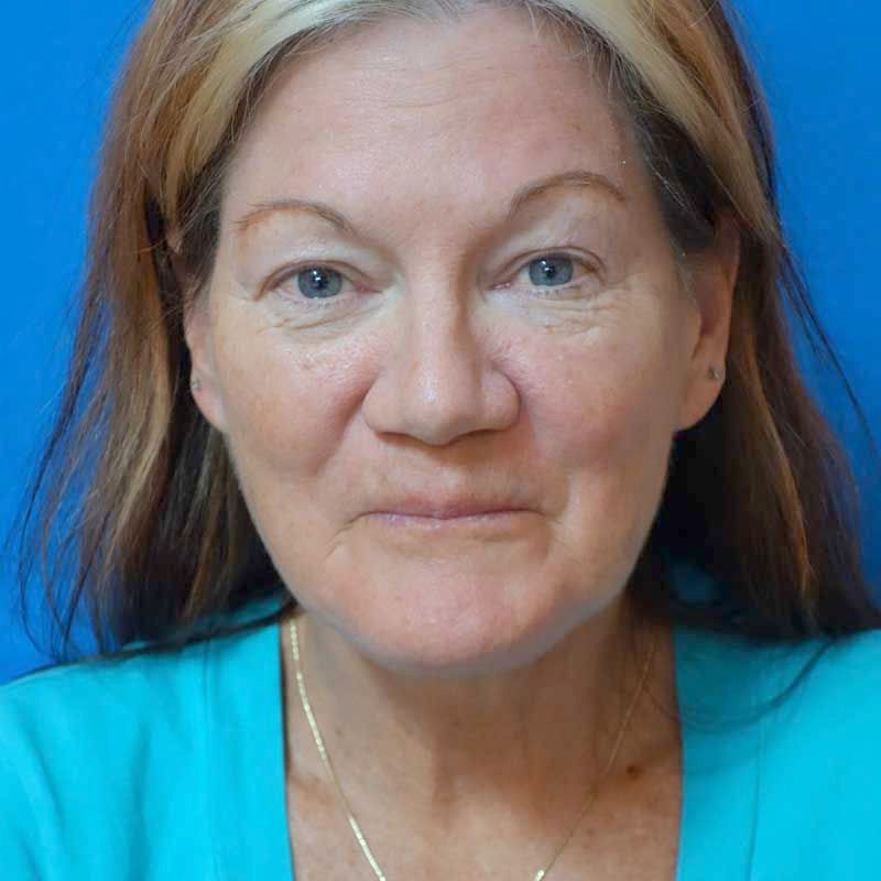 A close up of a woman's face wearing a blue shirt and a necklace