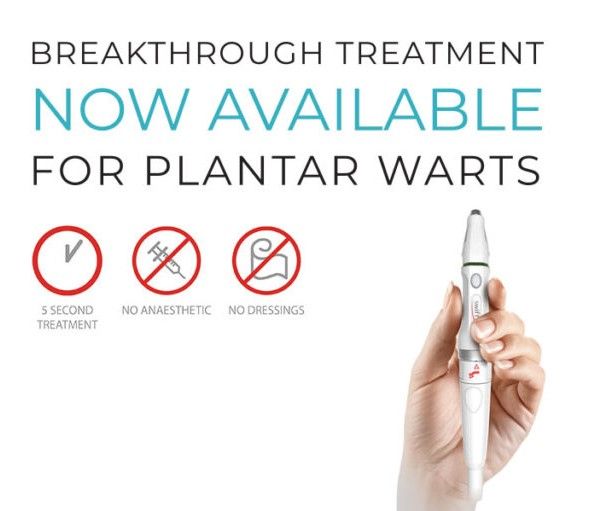 A hand holding a device that says breakthrough treatment now available for plantar warts