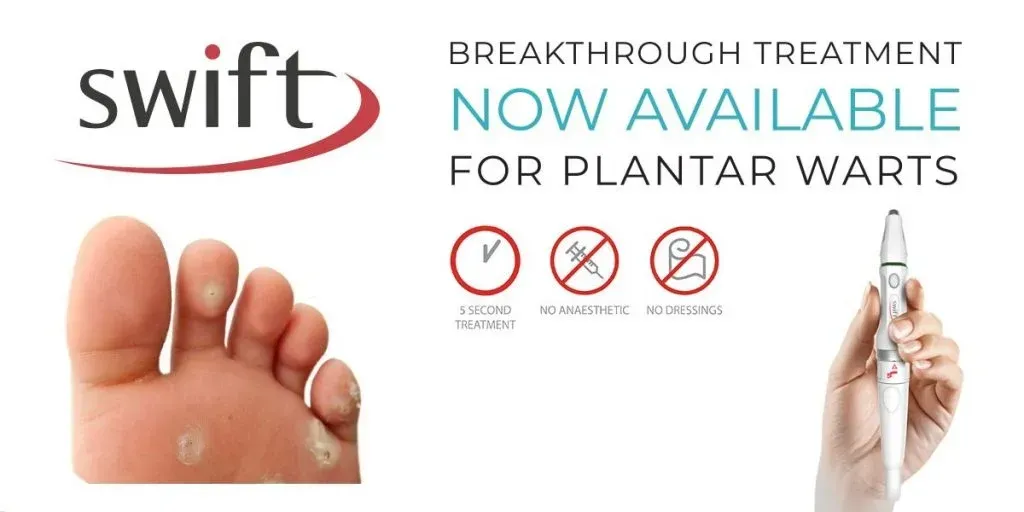 A swift breakthrough treatment is now available for plantar warts