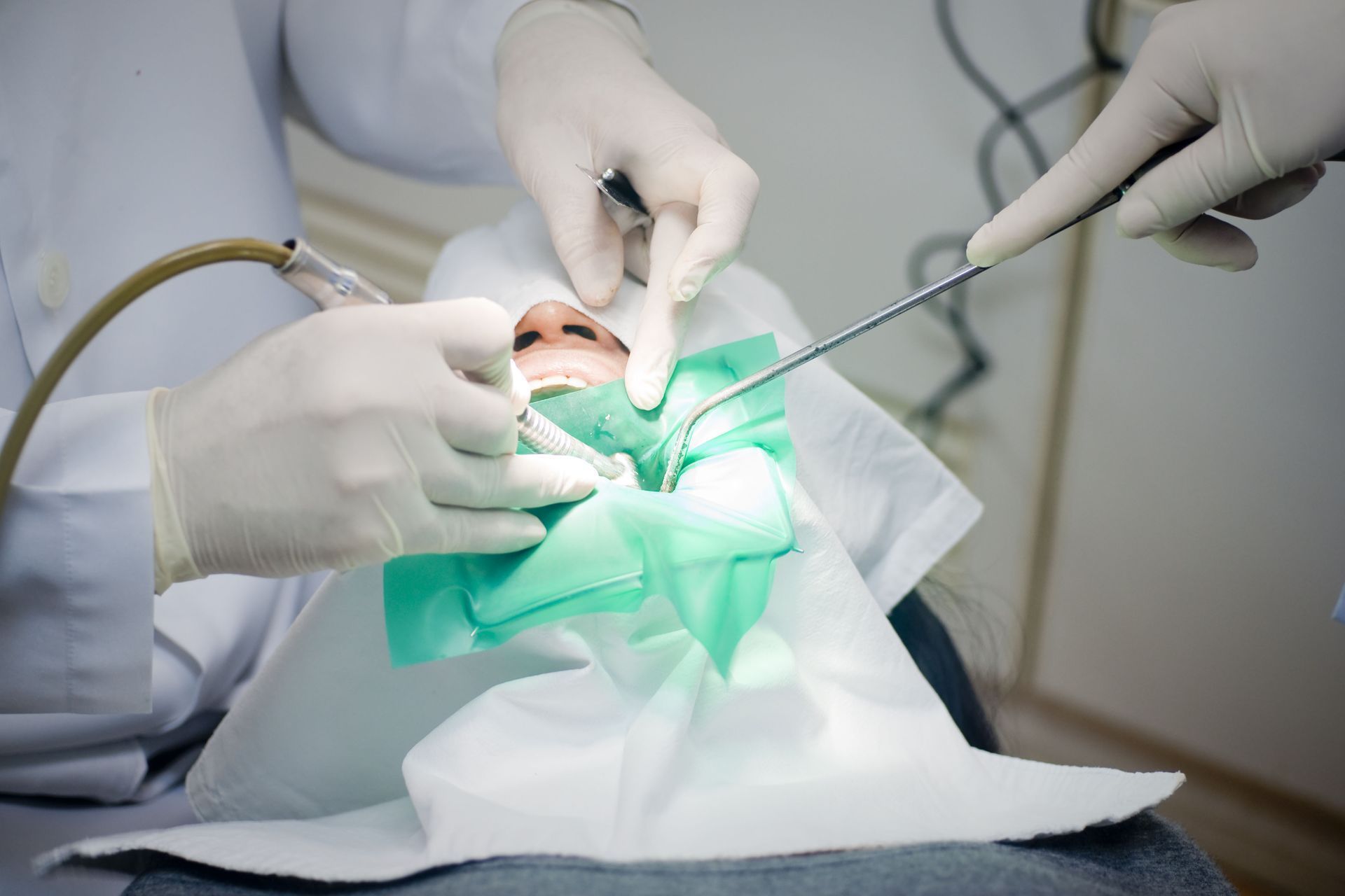 Dentist using tools to work on a patient's open mouth, covered with green and white sheets.