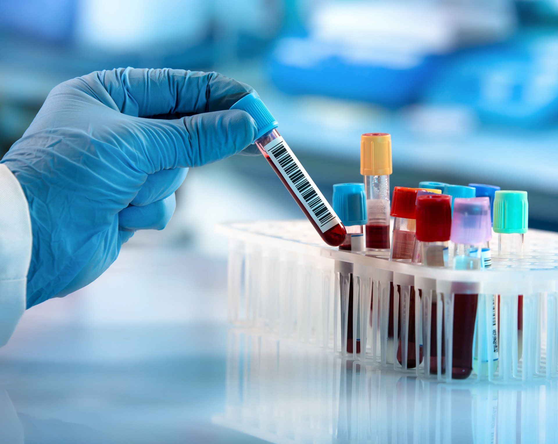 Blood testing service