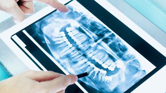 Dental radiology