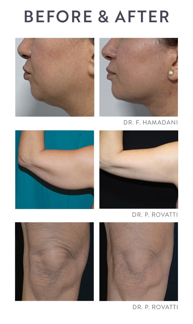 A before and after photo of a woman's face and arms