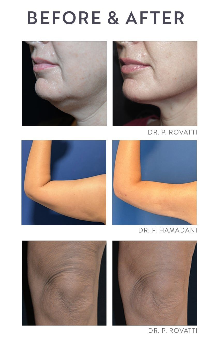 A before and after photo of a woman's face and arms