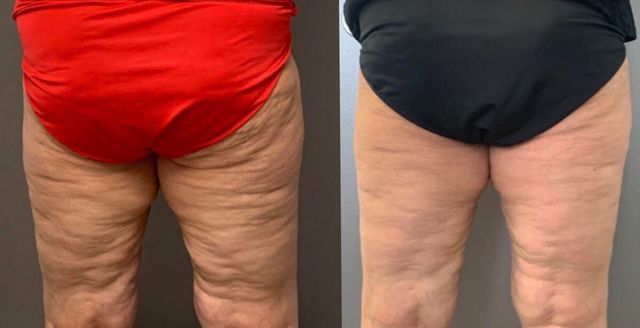 Back view of two people in red and black swimsuits showing wrinkled skin on thighs and buttocks