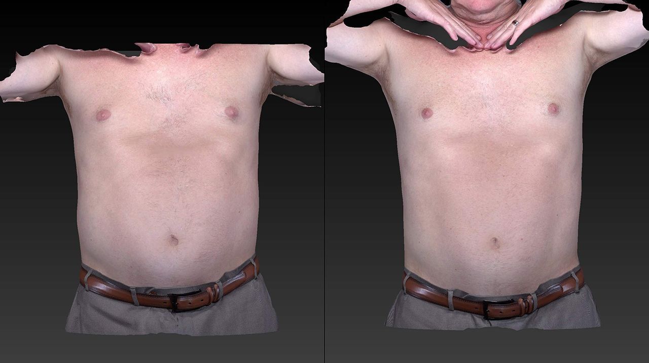 Side-by-side torso comparison showing a shirtless person in gray pants with a brown belt.