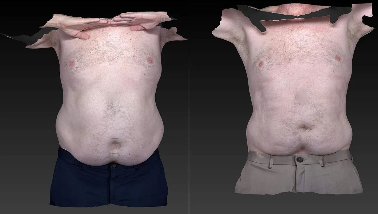 Side-by-side torso photos comparing a bare abdomen and the same torso with gray clothing over it