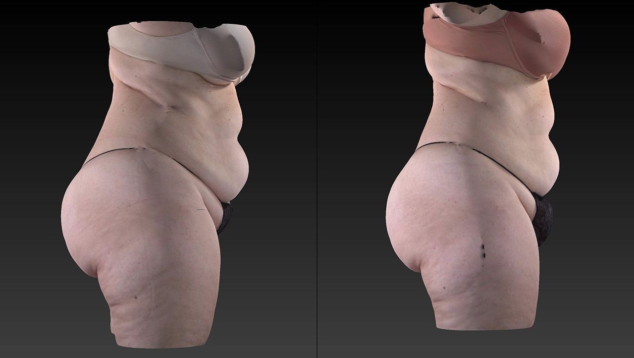 Two side-view 3D body scans of a person in beige clothing, shown side by side on a dark background.