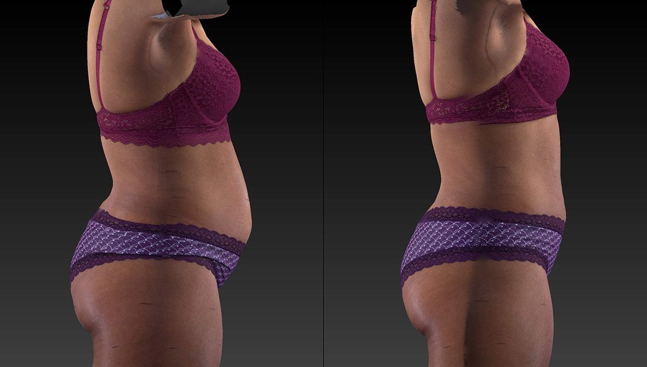 Side-by-side profile views of a person in purple bra and underwear against a dark background