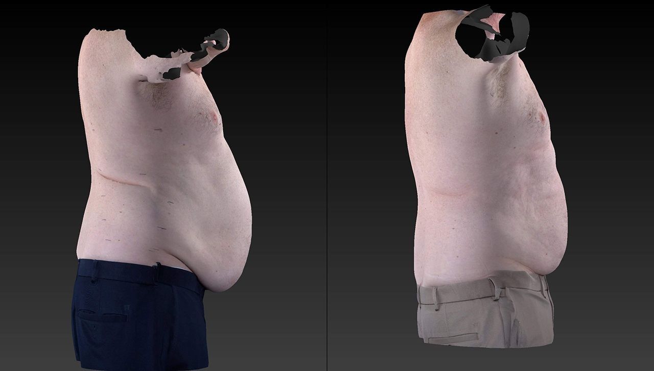 Side-by-side torso views of a shirtless person, showing a side profile with arms raised against a gray background.